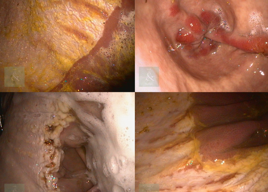 Ep. 33: A Deep Dive into Equine Gastric Ulcers; Part 1 – Diagnostics and Treatment