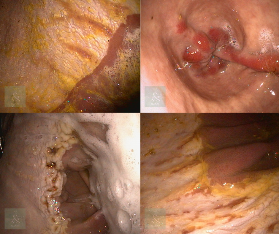 Equine Gastric Ulcers