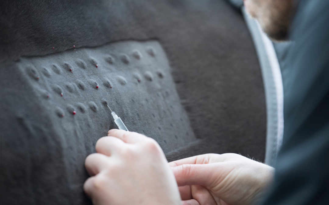 Ep. 76: Equine Allergies, Hives & Itchy Skin: What Horse Owners Need to Know