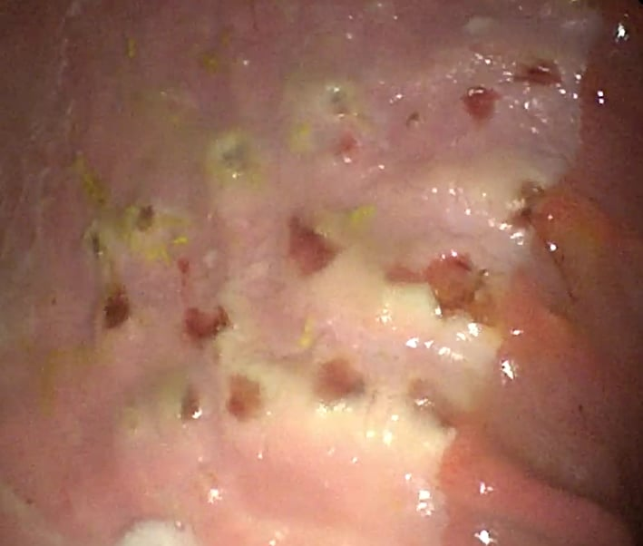 Uclers equine gastric ulcers